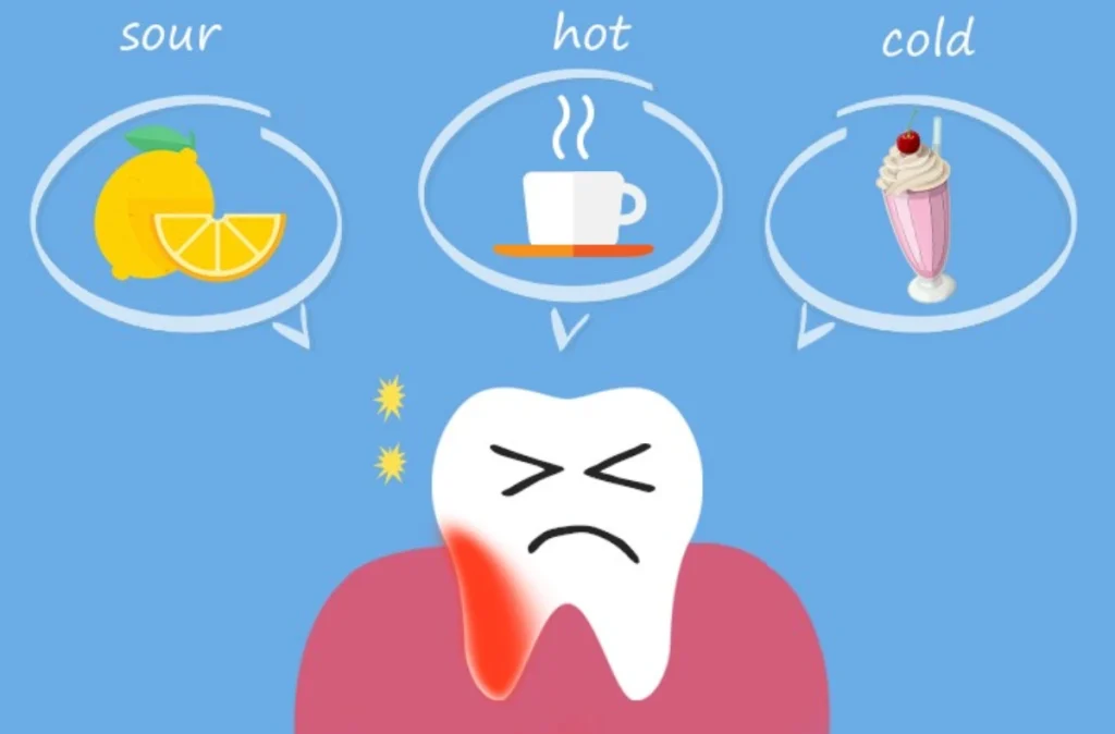 What is teeth sensitivity? 