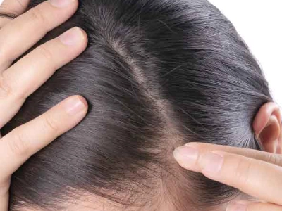 Thyroid disorders | What causes hair loss?