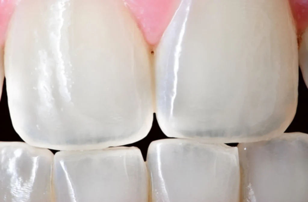 Do electric toothbrushes affect your enamel?