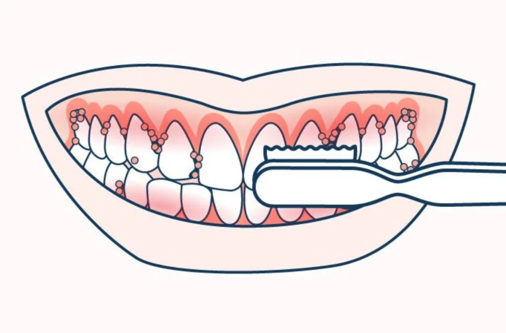 The benefits of using a hard bristle toothbrush