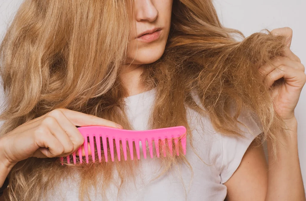 Brittle hair symptoms and signs