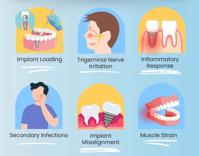 Toothache-induced migraine